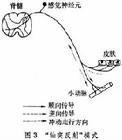  反射(受刺激物对刺激物的逆反应)