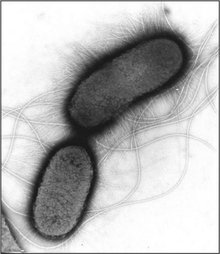 大肠杆菌革兰图片
