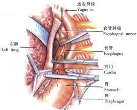 胸导管