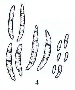 镰刀菌菌落形态特征图片