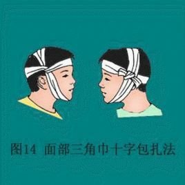 下颌包扎法图片