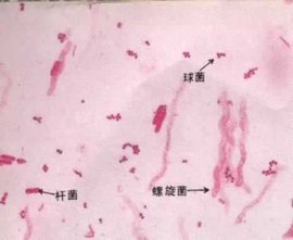 细菌培养