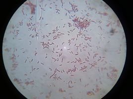 蜡样芽孢杆菌