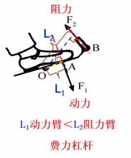 费力杠杆图图片