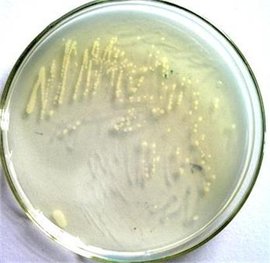 大肠杆菌DH5α_360百科