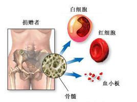 血小板减少：现代生活的隐形威胁