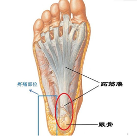 跟骨在哪个位置图片图片