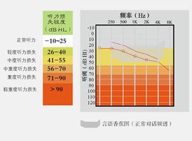 听力损失