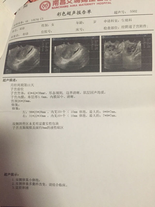闺蜜怀二胎瘢痕孕珠仍坚决坐蓐女子多次劝其终止孕珠无果又怀三胎闺蜜闹掰拉黑最终不测离世-2025年容县合爱女性健壮公益行为正正在实行中-跨境通股东户数降低433%户均持股294万元