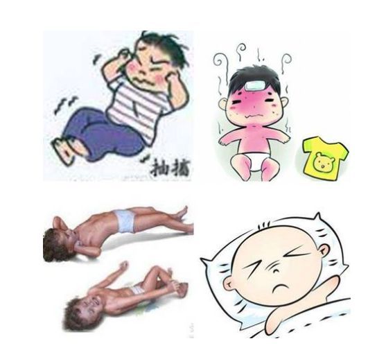 小儿热性惊厥图册_360百科