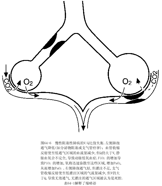 低氧血症图册_360百科