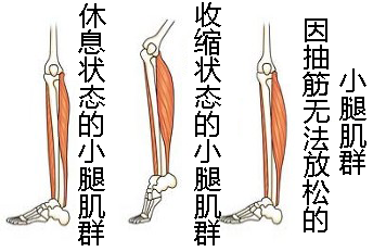 痉挛图册_360百科