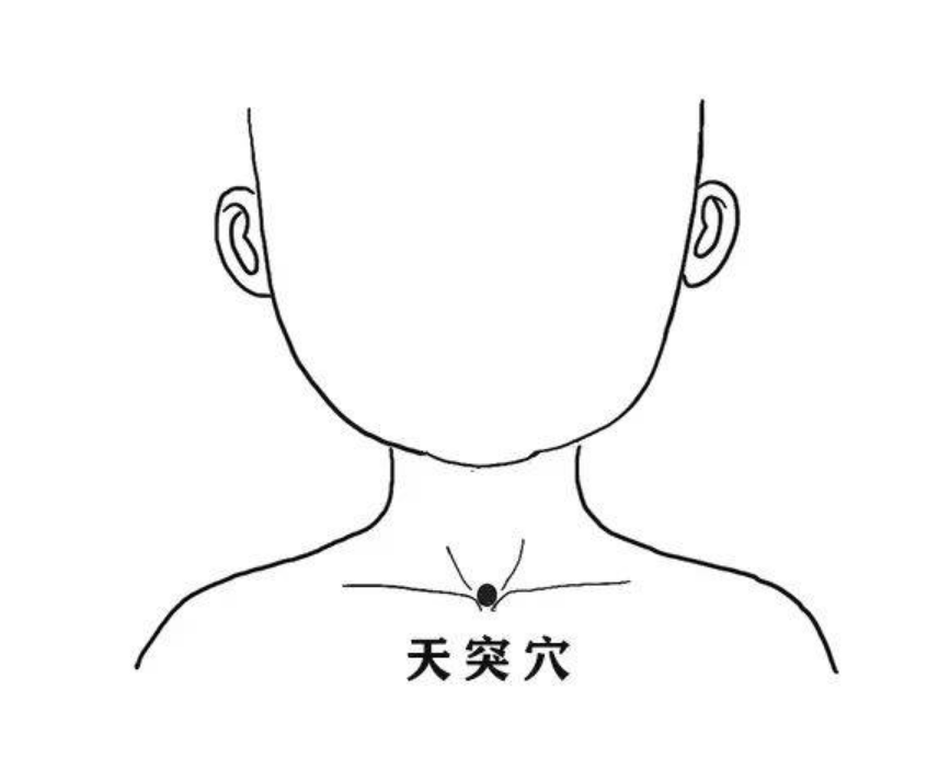 天突图册_360百科