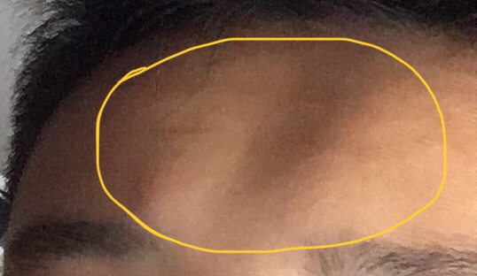 的额头的中间是凹陷下去的？如图。