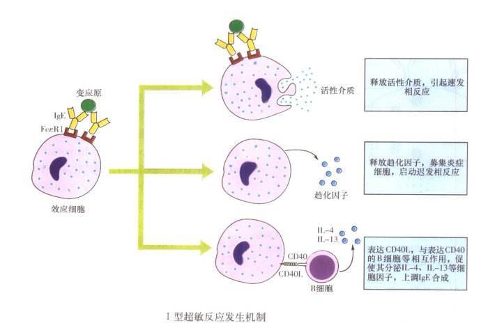 Ⅰ型超敏反应图册_360百科