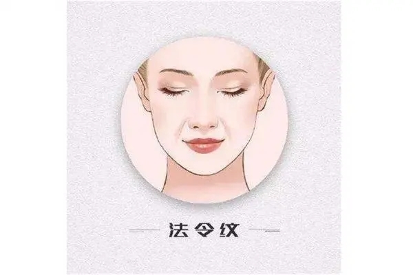法令纹图册_360百科