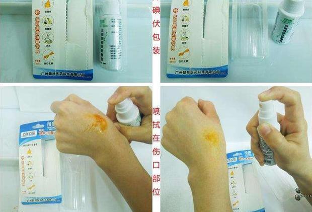 皮肤擦伤了怎么办_360新知