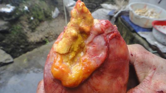 鸡宝是长在鸡哪个部位