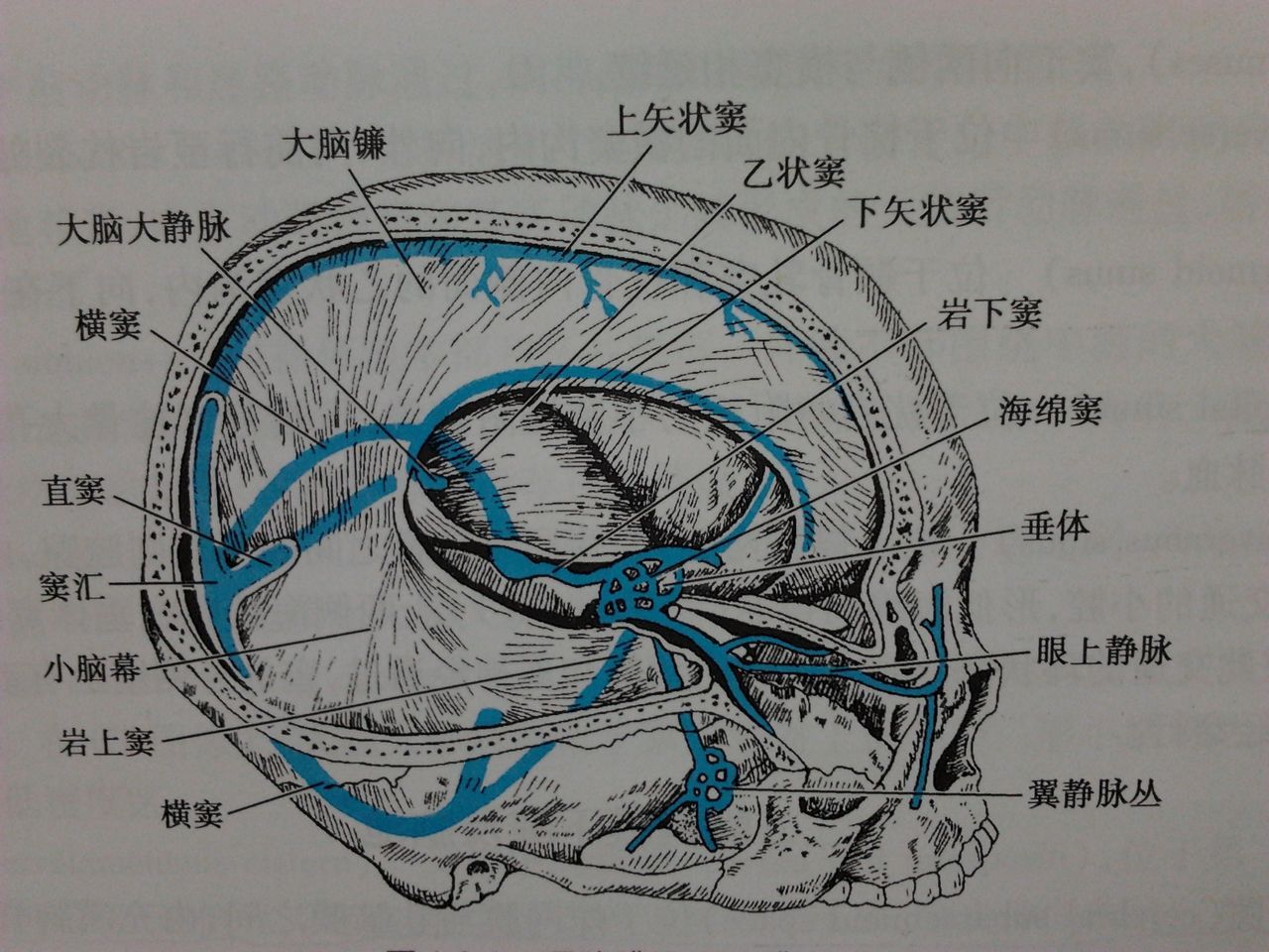 乙状窦解剖图片