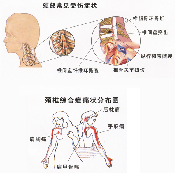 颈根部图册_360百科