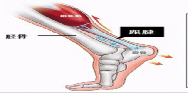 跟腱长度测量图解_360新知
