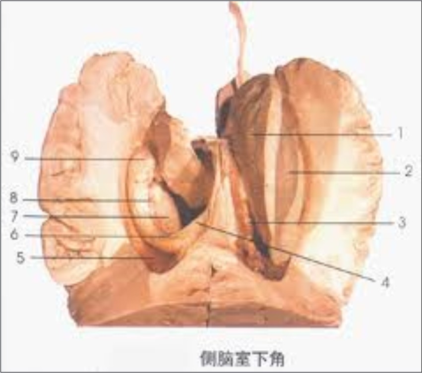 侧脑室图册_360百科