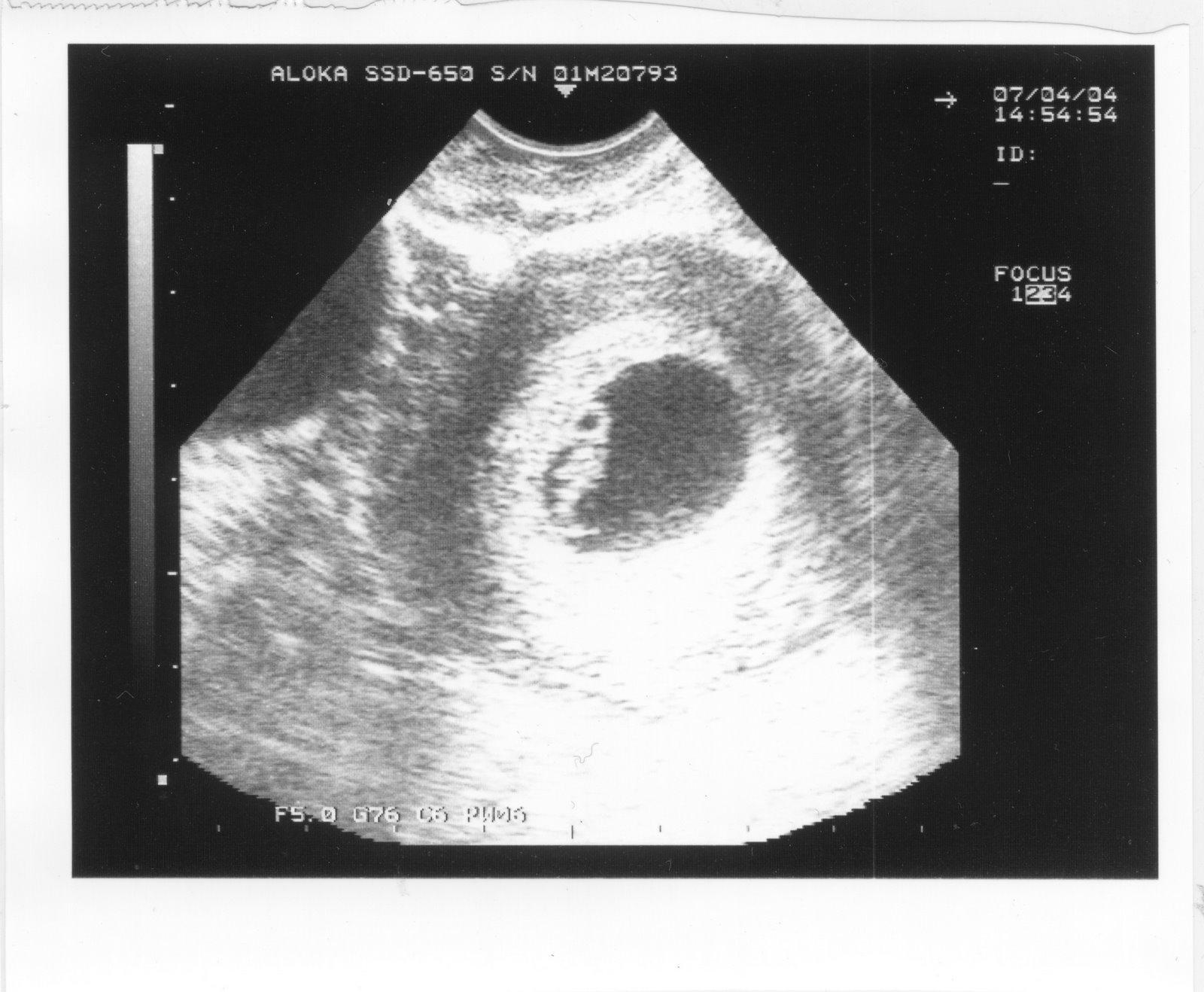 受精卵图册 360百科