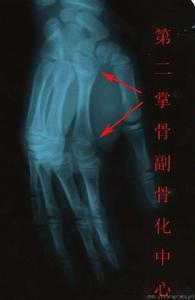 骨化中心_360百科