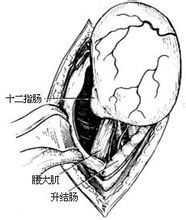肾门图册_360百科