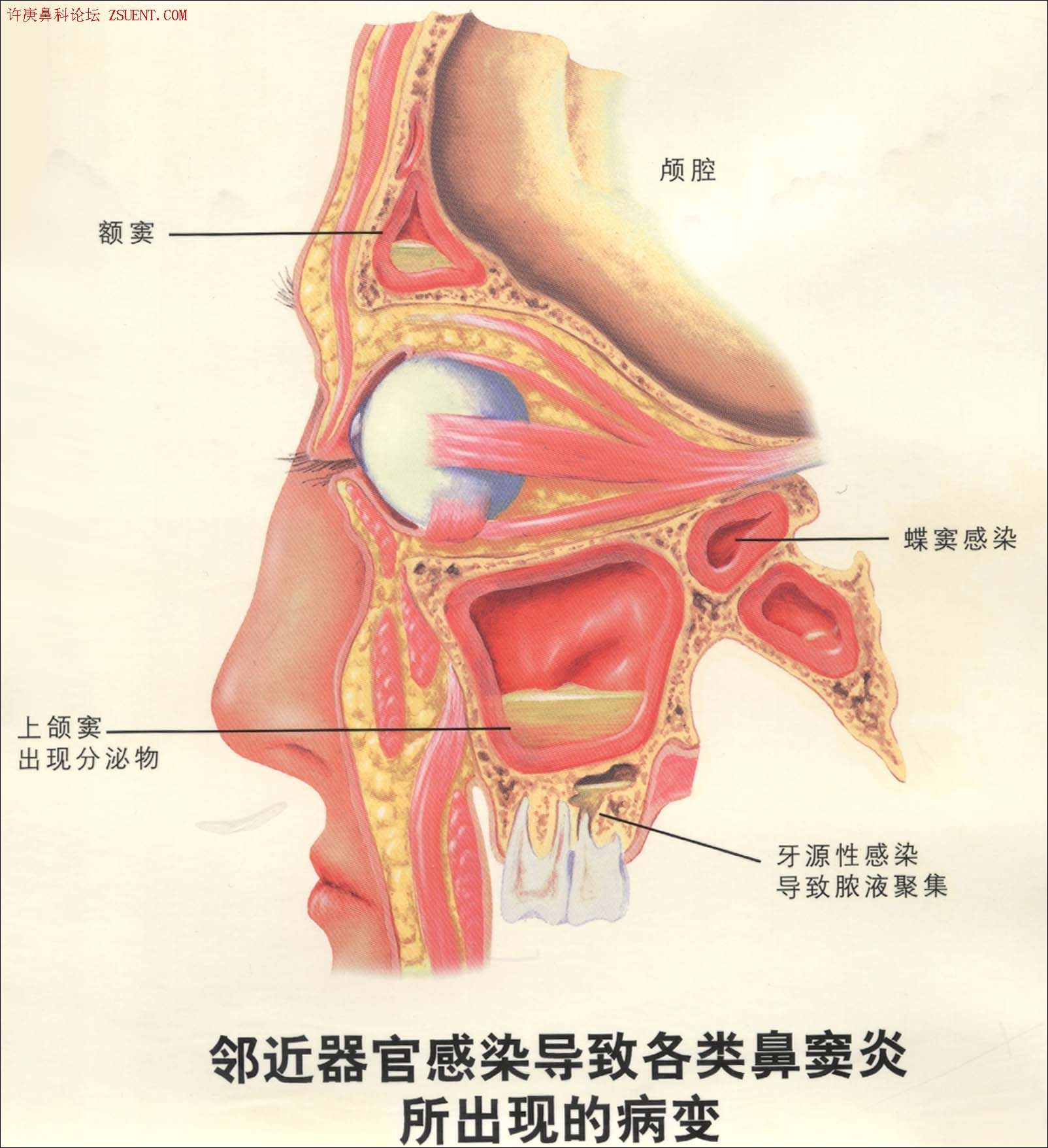 蝶窦位置图片图片