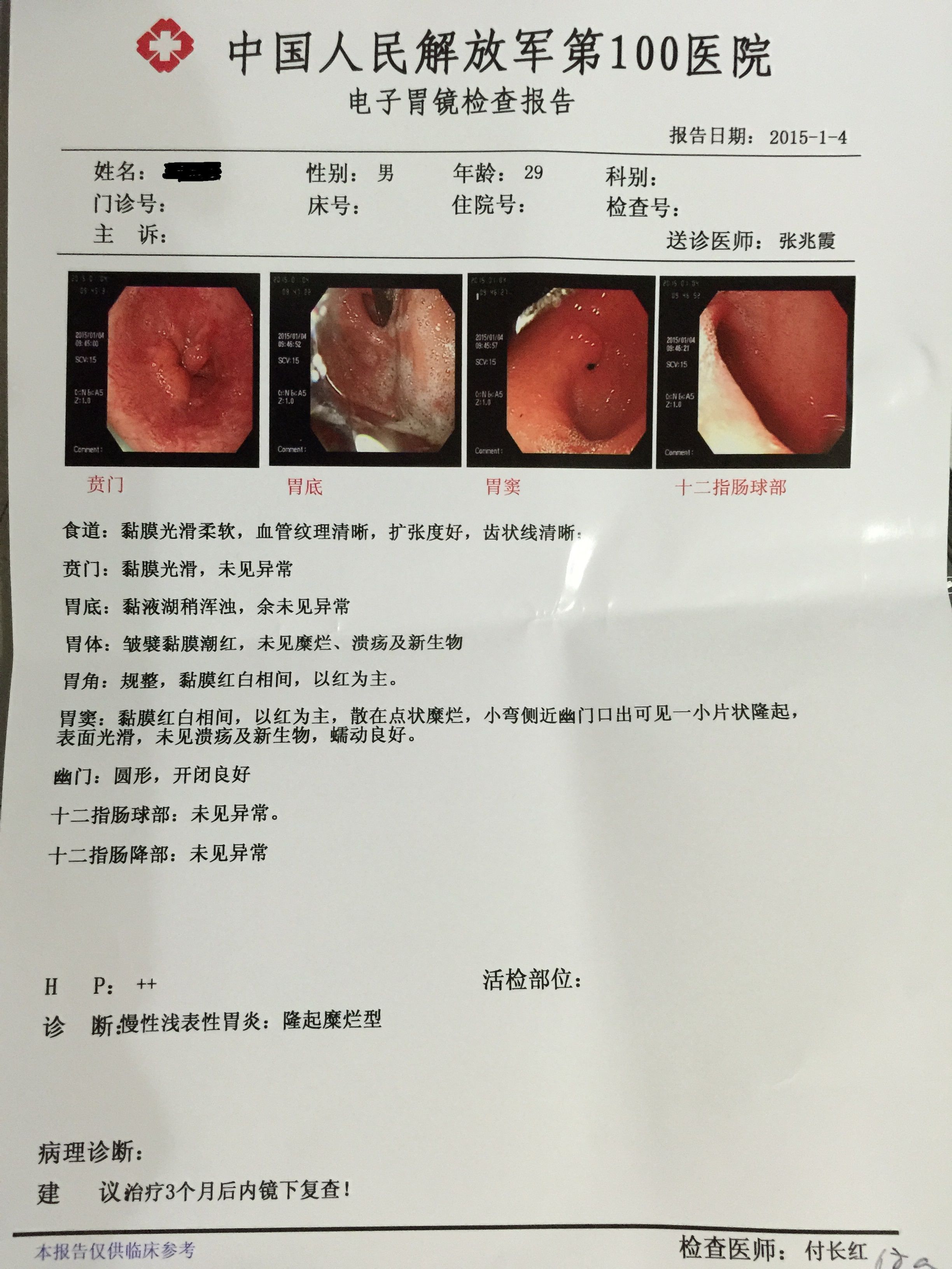 慢性浅表性胃炎图册_360百科