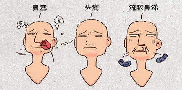 鼻窦炎的最佳治疗方法_360新知