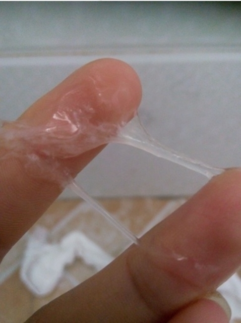 阴道分泌液图册