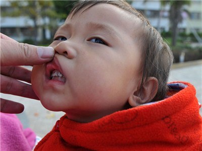 铅中毒的症状： (铅中毒的症状及体征)