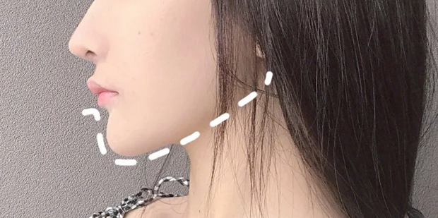 长了双下巴怎么办如何快速消除双下巴360新知 