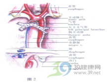 食管蹼图册_360百科