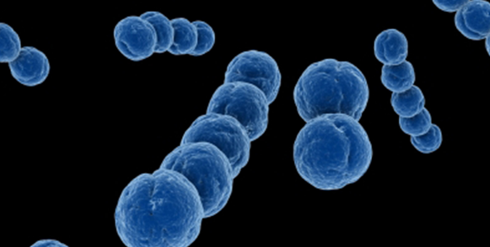 B族链球菌图册_360百科