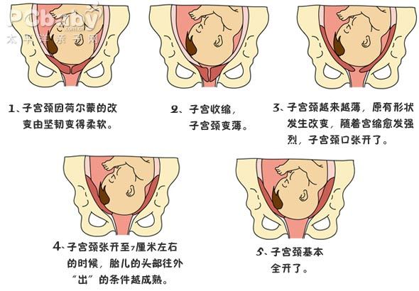 胎儿娩出的七个步骤图图片