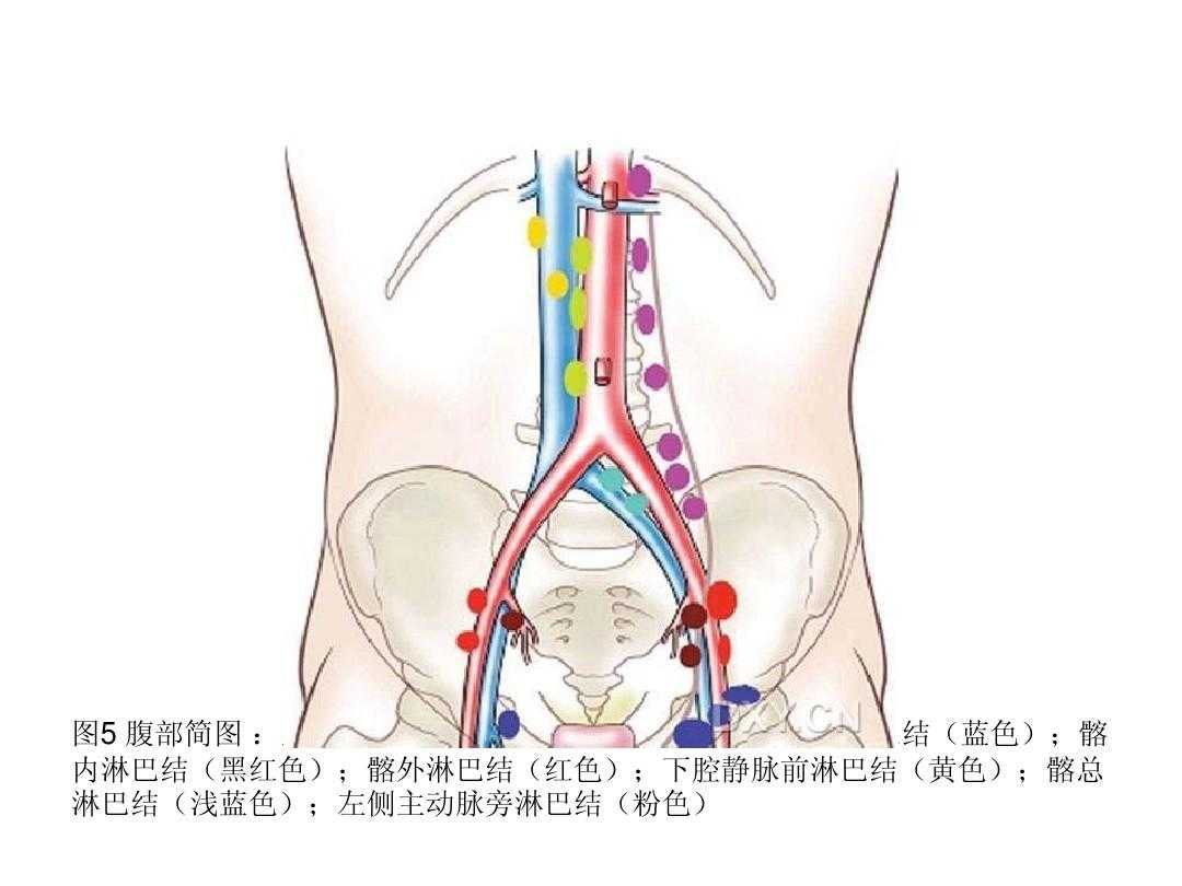 腹腔淋巴结分组图片