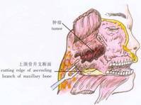 上颌骨图册_360百科