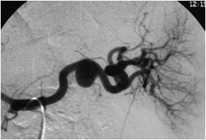 脾动脉图册_360百科